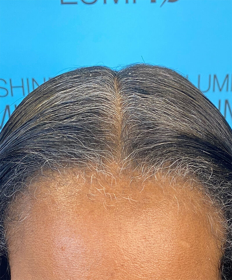 Before image
