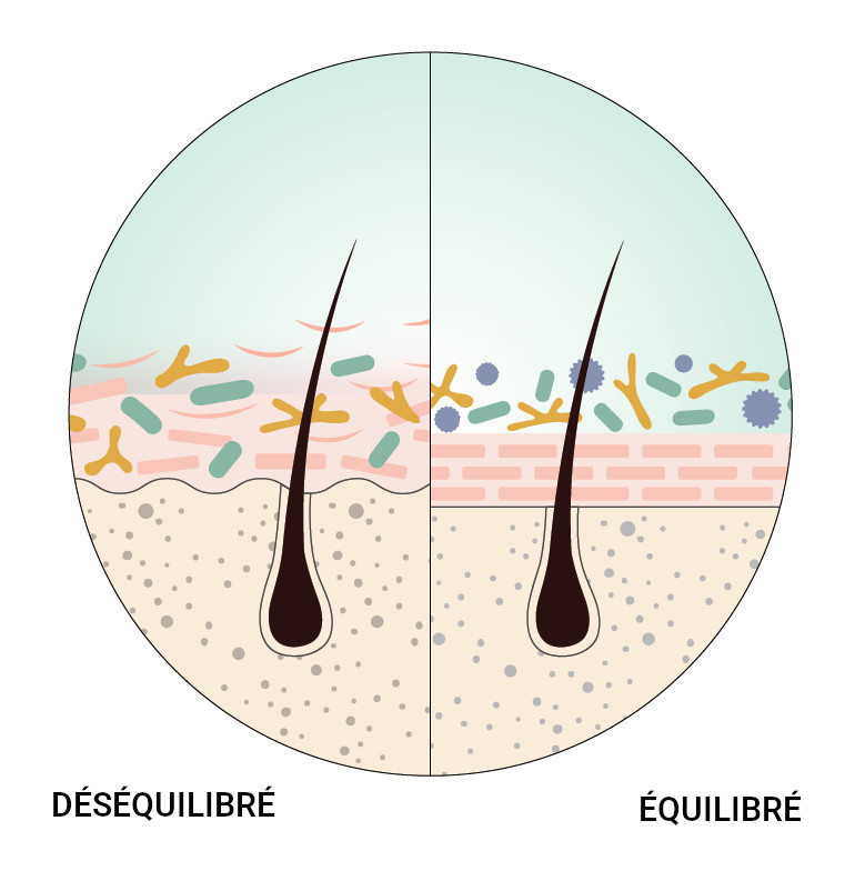 scalp illustration french